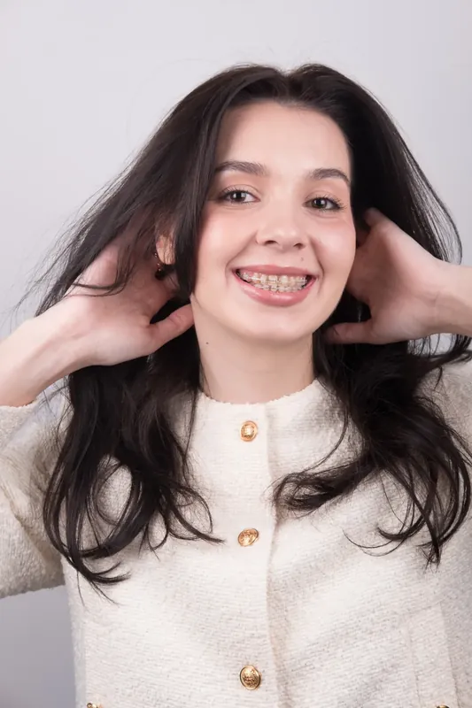Пациент Orthodontica с керамическими брекетами