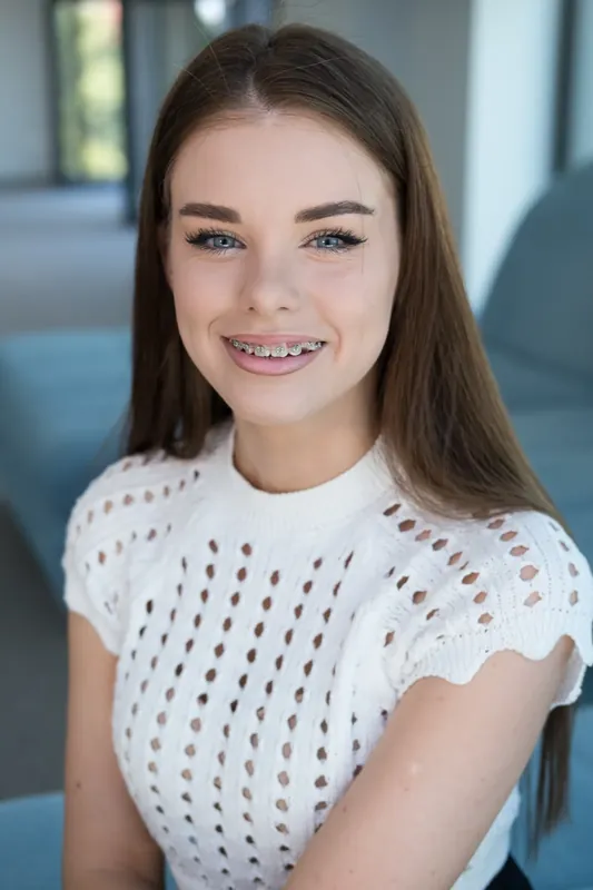 Пациент Orthodontica с металлическими брекетами