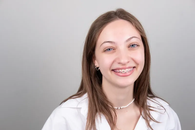 Пациент Orthodontica с металлическими брекетами