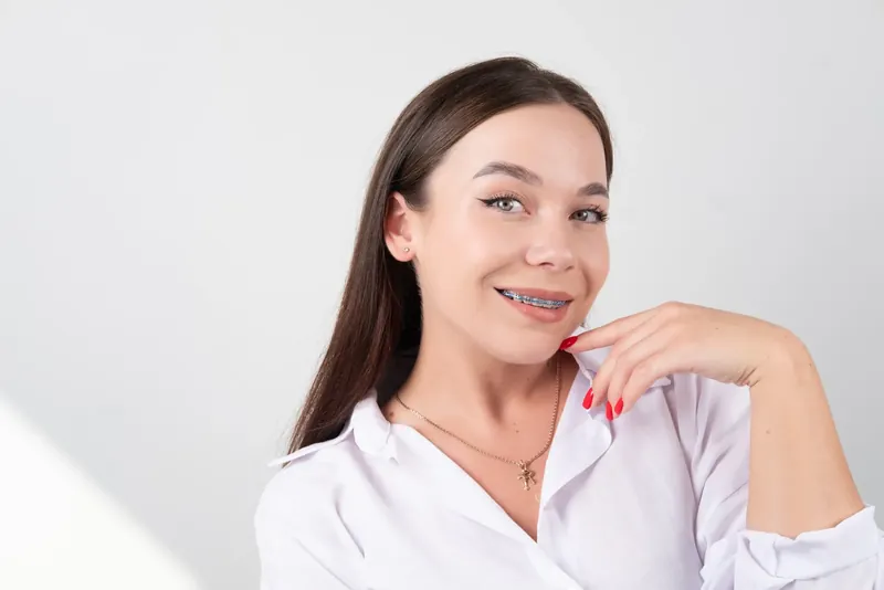 Пациент Orthodontica с металлическими брекетами