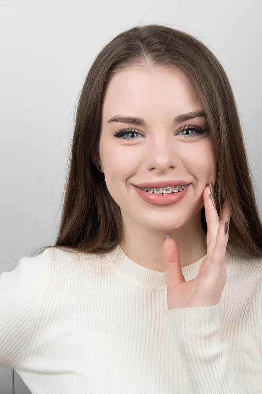 Пациент Orthodontica с металлическими брекетами