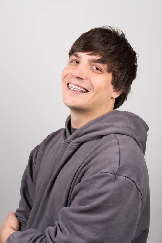 Пациент Orthodontica с металлическими брекетами