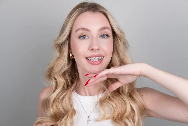 Пациент Orthodontica с металлическими брекетами